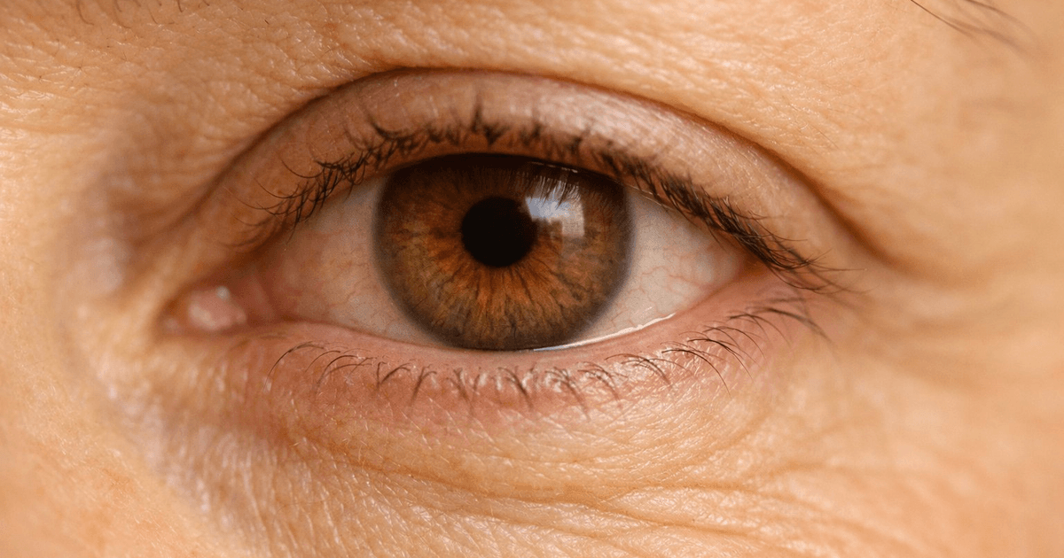 Paciente recibiendo evaluación oftalmológica para diagnóstico de ojo seco en la Clínica Dr. Diego Mena, Alajuela