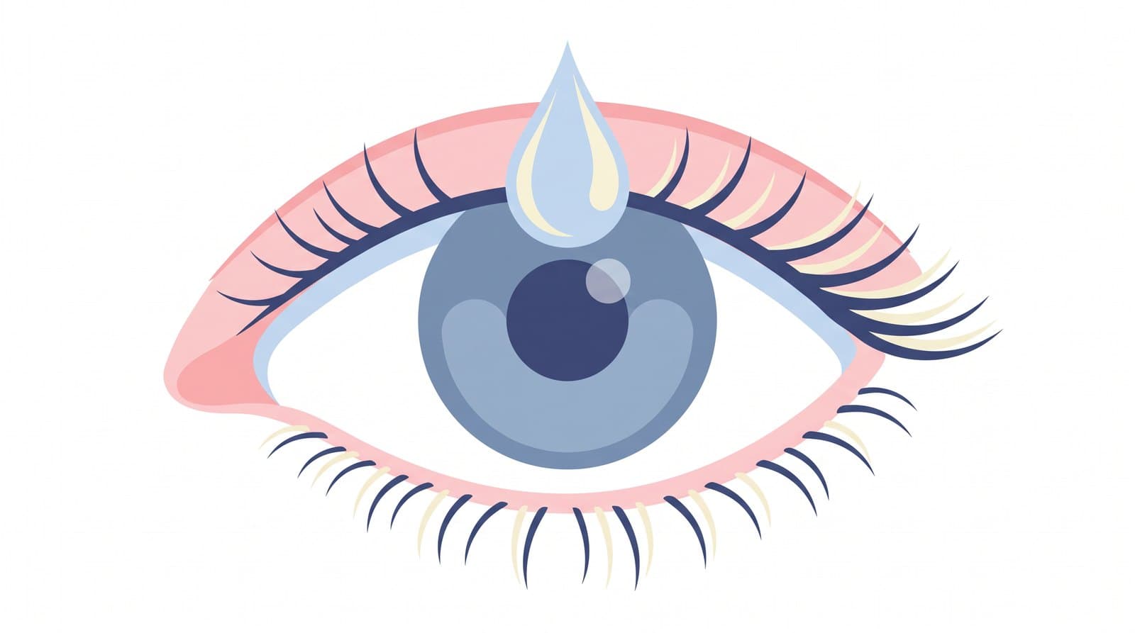 Ilustración: una gota anestésica cae sobre un ojo abierto y tranquilo.